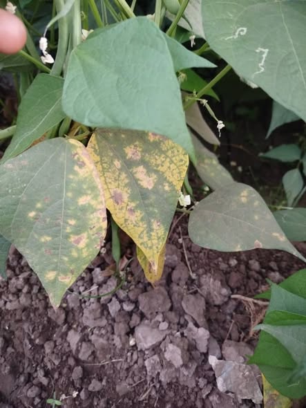 ممكن اعرف نوع الإصابة ؟